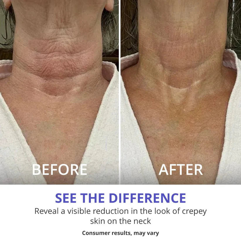 Revive Neck Cream